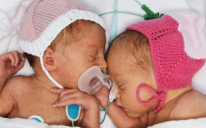 Sta mozemo da naucimo od prevremeno rodenih beba